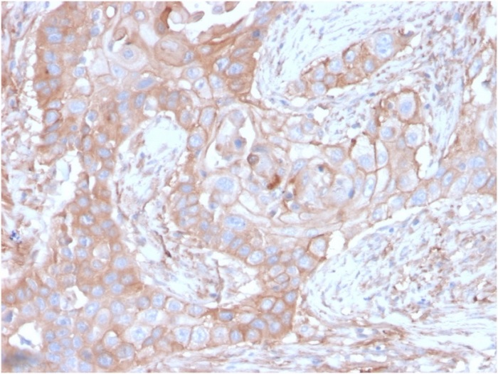 Immunohistochemistry (Formalin/PFA-fixed paraffin-embedded sections) - Anti-CD73 antibody [NT5E/2646] - BSA and Azide free (AB259284), expandable thumbnail