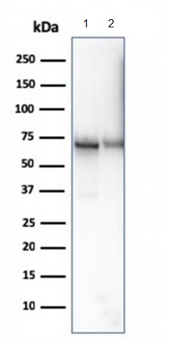 Western blot - Anti-CD73 antibody [NT5E/2646] - BSA and Azide free (AB259284), expandable thumbnail