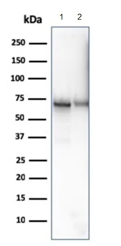 Western blot - Anti-CD73 antibody [NT5E/2646] - BSA and Azide free (AB259284)