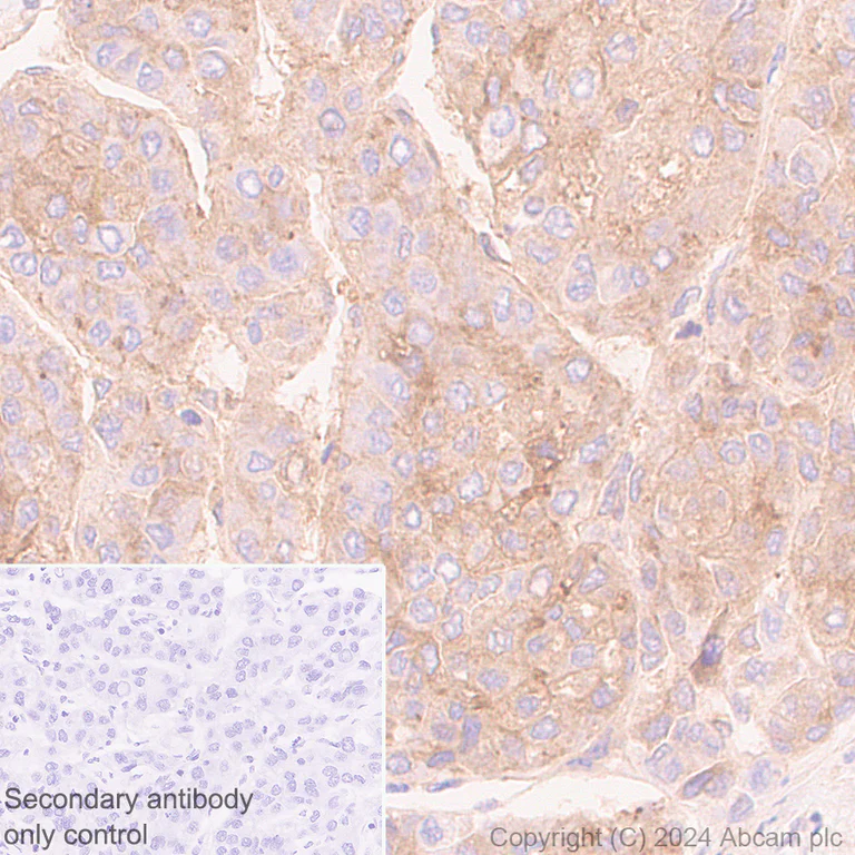 Immunohistochemistry (Formalin/PFA-fixed paraffin-embedded sections) - Anti-CD73 antibody [RM2050] (AB317462)