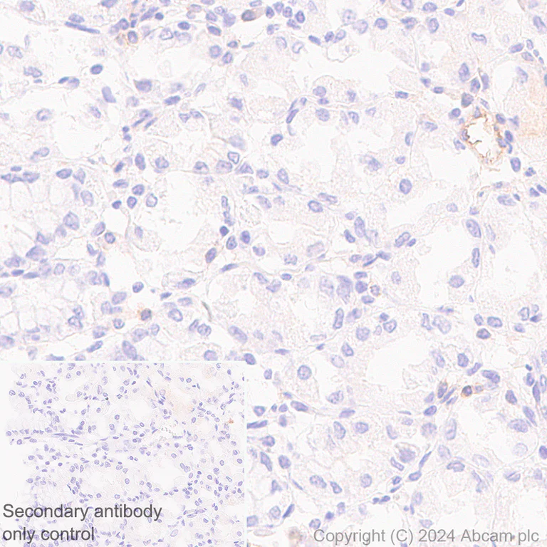 Immunohistochemistry (Formalin/PFA-fixed paraffin-embedded sections) - Anti-CD73 antibody [RM2050] (AB317462)