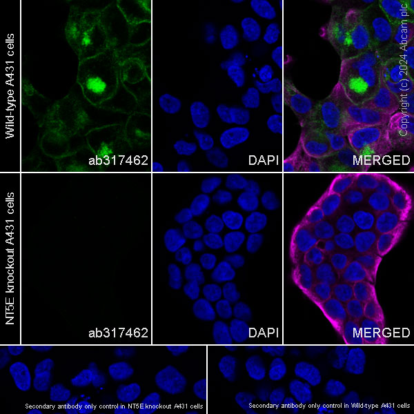 Immunocytochemistry/ Immunofluorescence - Anti-CD73 antibody [RM2050] - BSA and Azide free (ab317463), expandable thumbnail