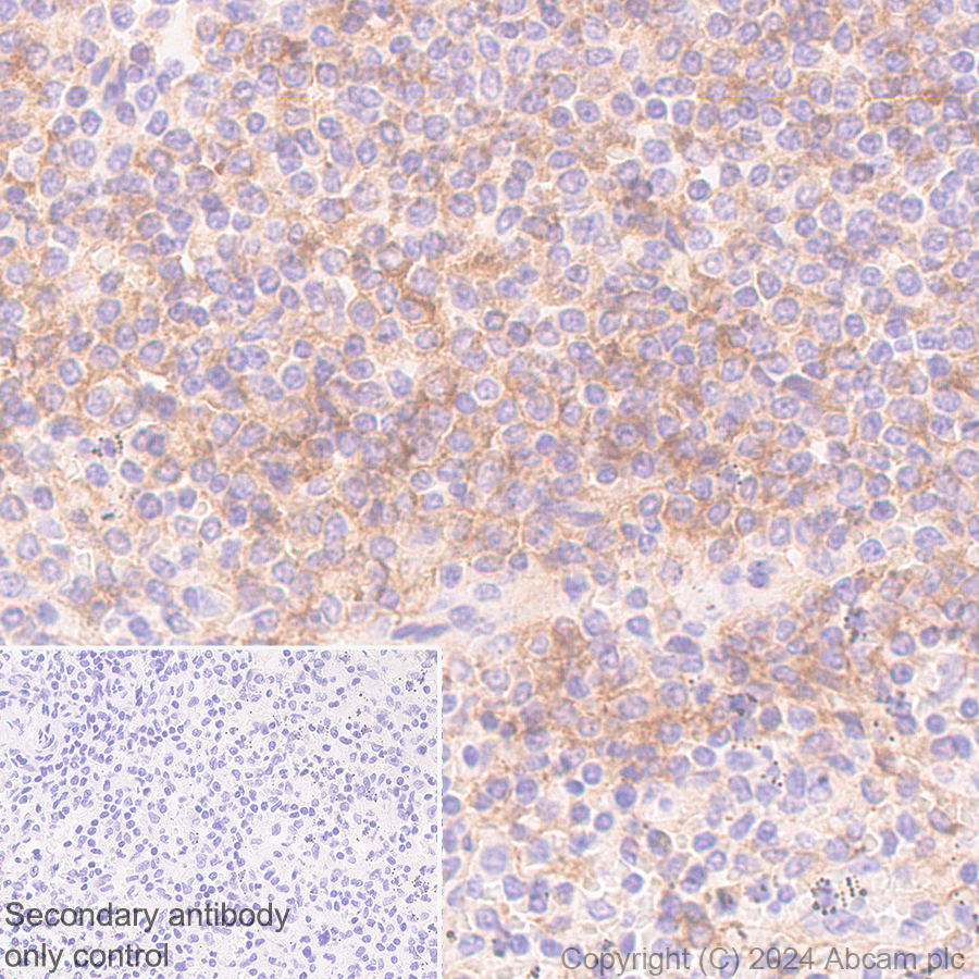 Immunohistochemistry (Formalin/PFA-fixed paraffin-embedded sections) - Anti-CD73 antibody [RM2050] - BSA and Azide free (ab317463), expandable thumbnail