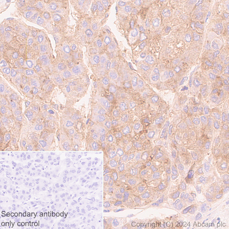 Immunohistochemistry (Formalin/PFA-fixed paraffin-embedded sections) - Anti-CD73 antibody [RM2050] - BSA and Azide free (ab317463), expandable thumbnail