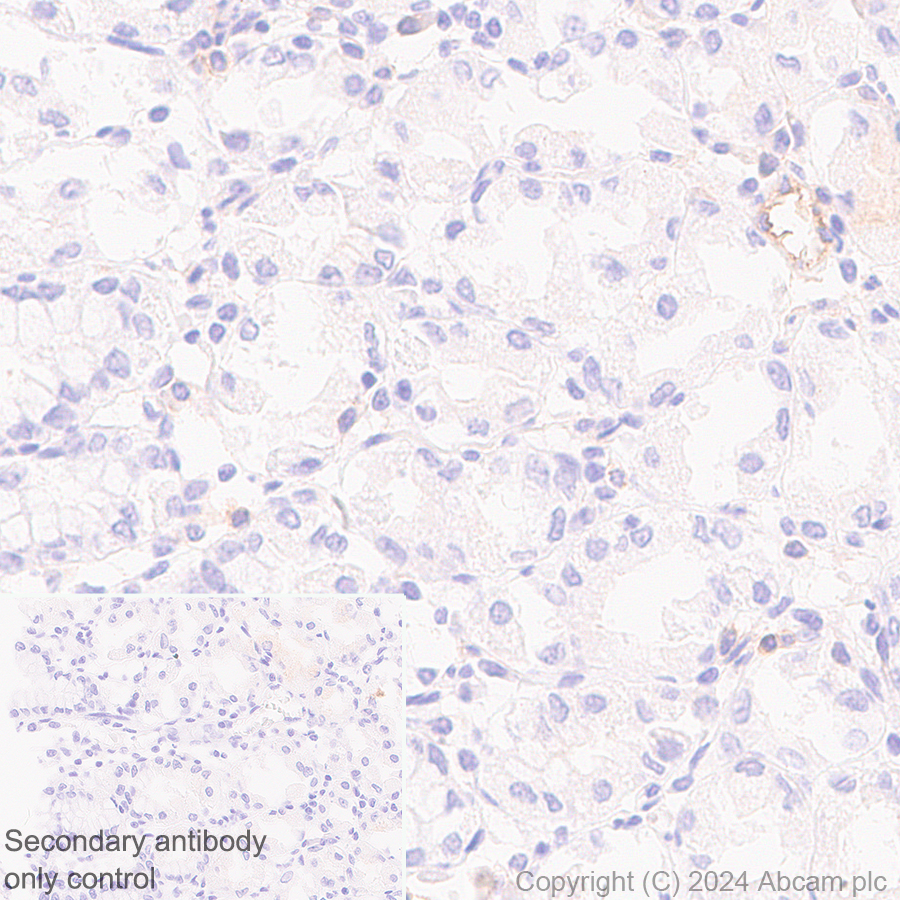 Immunohistochemistry (Formalin/PFA-fixed paraffin-embedded sections) - Anti-CD73 antibody [RM2050] - BSA and Azide free (AB317463), expandable thumbnail