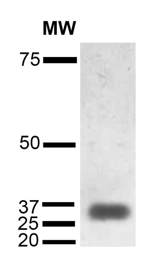 Western blot - Anti-CD74 antibody [1B8] (AB223350), expandable thumbnail