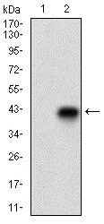 Western blot - Anti-CD74 antibody [2D1B3] - N-terminal (AB181465)