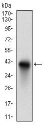 Western blot - Anti-CD74 antibody [2D1B3] - N-terminal (AB181465), expandable thumbnail