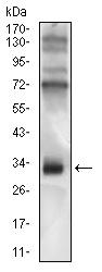 Western blot - Anti-CD74 antibody [2D1B3] - N-terminal (AB181465), expandable thumbnail
