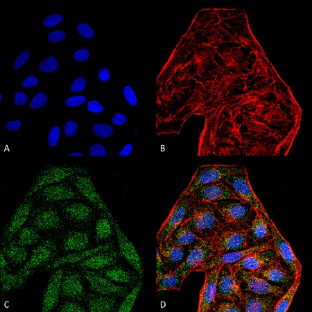 Immunocytochemistry/ Immunofluorescence - Anti-CD74 antibody [6D9] (AB223357), expandable thumbnail