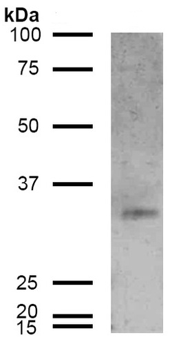 Western blot - Anti-CD74 antibody [6D9] (AB223357), expandable thumbnail