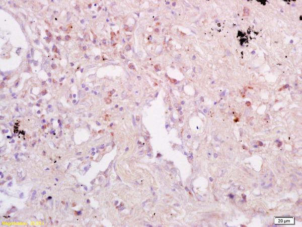 Immunohistochemistry (Formalin/PFA-fixed paraffin-embedded sections) - Anti-CD74 antibody (AB202844), expandable thumbnail