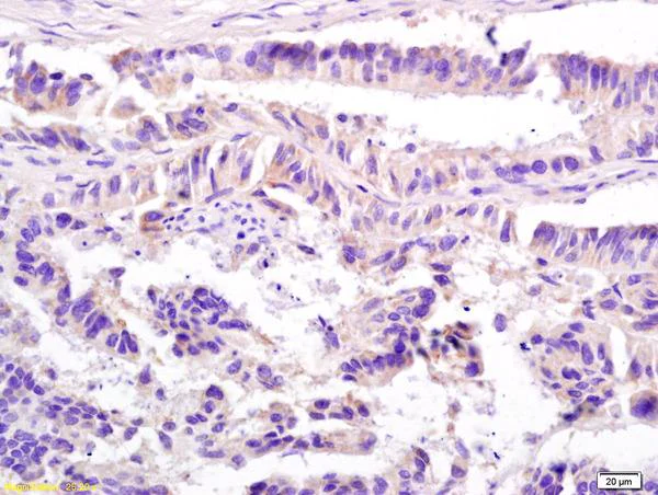 Immunohistochemistry (Formalin/PFA-fixed paraffin-embedded sections) - Anti-CD74 antibody (AB202844)