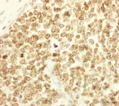 Immunohistochemistry (Formalin/PFA-fixed paraffin-embedded sections) - Anti-CD74 antibody (AB64772)