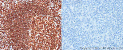 Immunohistochemistry (Formalin/PFA-fixed paraffin-embedded sections) - Anti-CD74 antibody (AB64772)
