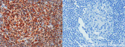Immunohistochemistry (Formalin/PFA-fixed paraffin-embedded sections) - Anti-CD74 antibody (AB64772)
