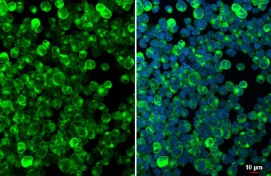Immunocytochemistry/ Immunofluorescence - Anti-CD74 antibody (AB97479)