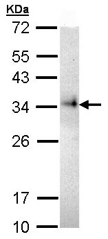 Western blot - Anti-CD74 antibody (AB97479), expandable thumbnail
