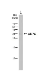 Western blot - Anti-CD74 antibody (AB97479)