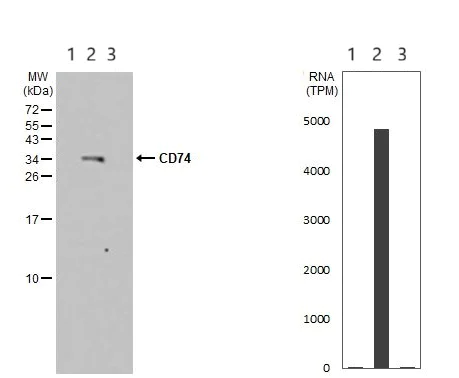 Western blot - Anti-CD74 antibody (AB97479)
