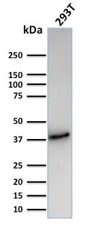 Western blot - Anti-CD74 antibody [CLIP/3127R] (AB270265)