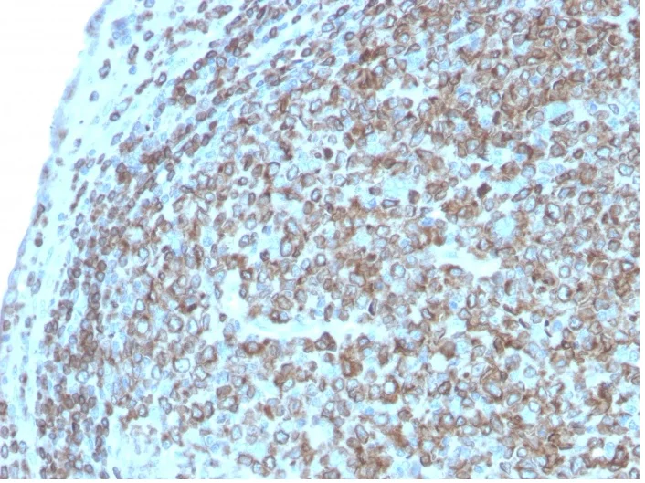 Immunohistochemistry (Formalin/PFA-fixed paraffin-embedded sections) - Anti-CD74 antibody [CLIP/3127R] - BSA and Azide free (AB270296)