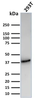 Western blot - Anti-CD74 antibody [CLIP/3127R] - BSA and Azide free (AB270296)
