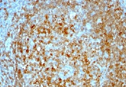 Immunohistochemistry (Formalin/PFA-fixed paraffin-embedded sections) - Anti-CD74 antibody [CLIP/813] (AB215898), expandable thumbnail