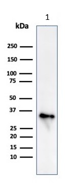 Western blot - Anti-CD74 antibody [CLIP/813] (AB215898), expandable thumbnail