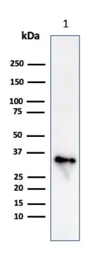 Western blot - Anti-CD74 antibody [CLIP/813] (AB215898)