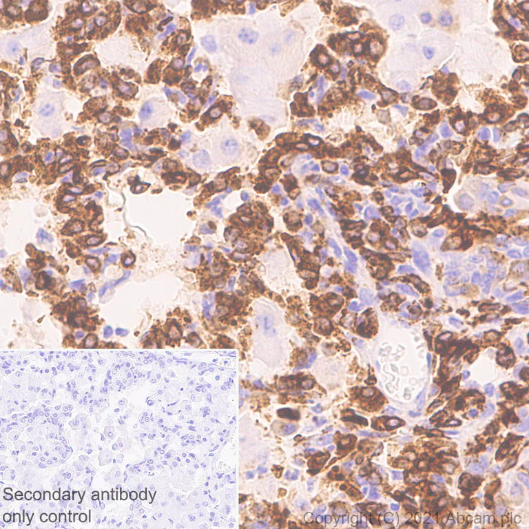 Immunohistochemistry (Formalin/PFA-fixed paraffin-embedded sections) - Anti-CD74 antibody [EPR25399-94] - BSA and Azide free (AB289891)