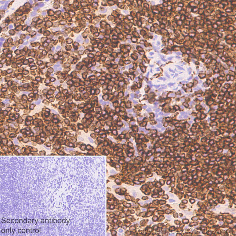 Immunohistochemistry (Formalin/PFA-fixed paraffin-embedded sections) - Anti-CD74 antibody [EPR25399-94] - BSA and Azide free (AB289891)