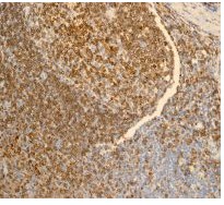 Immunohistochemistry (Formalin/PFA-fixed paraffin-embedded sections) - Anti-CD74 antibody [EPR4064] (AB108393), expandable thumbnail