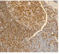 Immunohistochemistry (Formalin/PFA-fixed paraffin-embedded sections) - Anti-CD74 antibody [EPR4064] (AB108393)