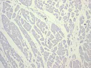 Immunohistochemistry (Formalin/PFA-fixed paraffin-embedded sections) - Anti-CD74 antibody [EPR4064] (ab108393), expandable thumbnail