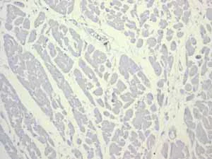 Immunohistochemistry (Formalin/PFA-fixed paraffin-embedded sections) - Anti-CD74 antibody [EPR4064] (AB108393)