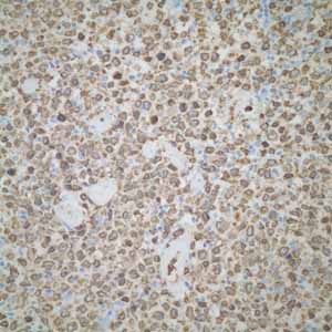 Immunohistochemistry (Formalin/PFA-fixed paraffin-embedded sections) - Anti-CD74 antibody [EPR4064] (ab108393), expandable thumbnail