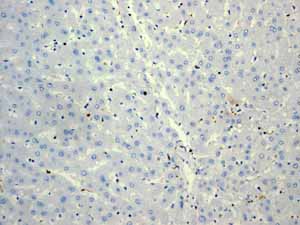 Immunohistochemistry (Formalin/PFA-fixed paraffin-embedded sections) - Anti-CD74 antibody [EPR4064] (ab108393), expandable thumbnail
