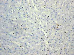 Immunohistochemistry (Formalin/PFA-fixed paraffin-embedded sections) - Anti-CD74 antibody [EPR4064] (AB108393)