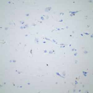 Immunohistochemistry (Formalin/PFA-fixed paraffin-embedded sections) - Anti-CD74 antibody [EPR4064] (ab108393), expandable thumbnail