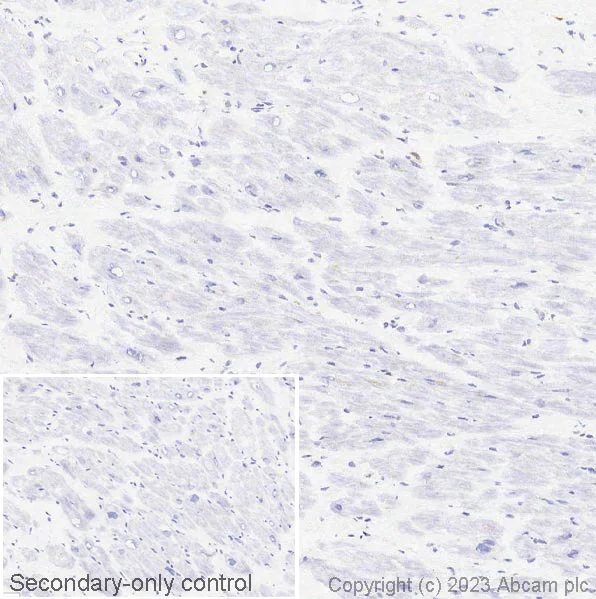 Immunohistochemistry (Frozen sections) - Anti-CD74 antibody [EPR4064] (AB108393)