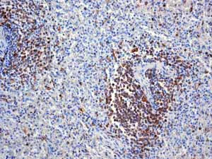 Immunohistochemistry (Formalin/PFA-fixed paraffin-embedded sections) - Anti-CD74 antibody [EPR4064] - BSA and Azide free (AB247655)