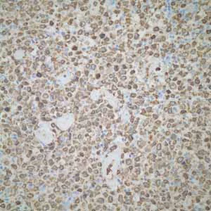 Immunohistochemistry (Formalin/PFA-fixed paraffin-embedded sections) - Anti-CD74 antibody [EPR4064] - BSA and Azide free (AB247655)