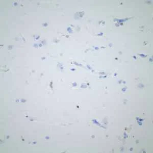 Immunohistochemistry (Formalin/PFA-fixed paraffin-embedded sections) - Anti-CD74 antibody [EPR4064] - BSA and Azide free (AB247655)