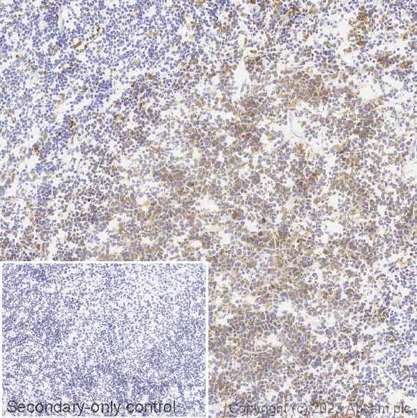 Immunohistochemistry (Frozen sections) - Anti-CD74 antibody [EPR4064] - BSA and Azide free (AB247655)