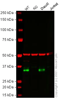Western blot - Anti-CD74 antibody [EPR4064] - BSA and Azide free (AB247655)