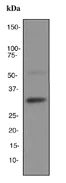 Western blot - Anti-CD74 antibody [EPR4064] - BSA and Azide free (AB247655)