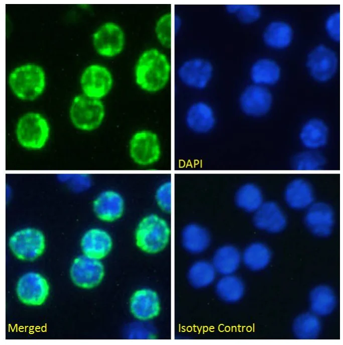 Immunocytochemistry/ Immunofluorescence - Anti-CD74 antibody [In-1] (AB245692)