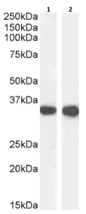 Western blot - Anti-CD74 antibody [In-1] (AB245692)