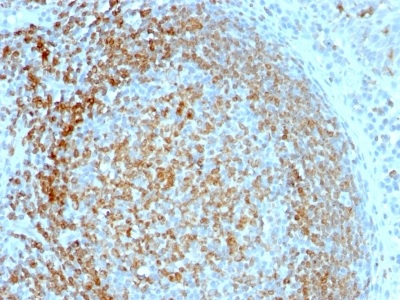 Immunohistochemistry (Formalin/PFA-fixed paraffin-embedded sections) - Anti-CD74 antibody [LN-2] (AB234017), expandable thumbnail